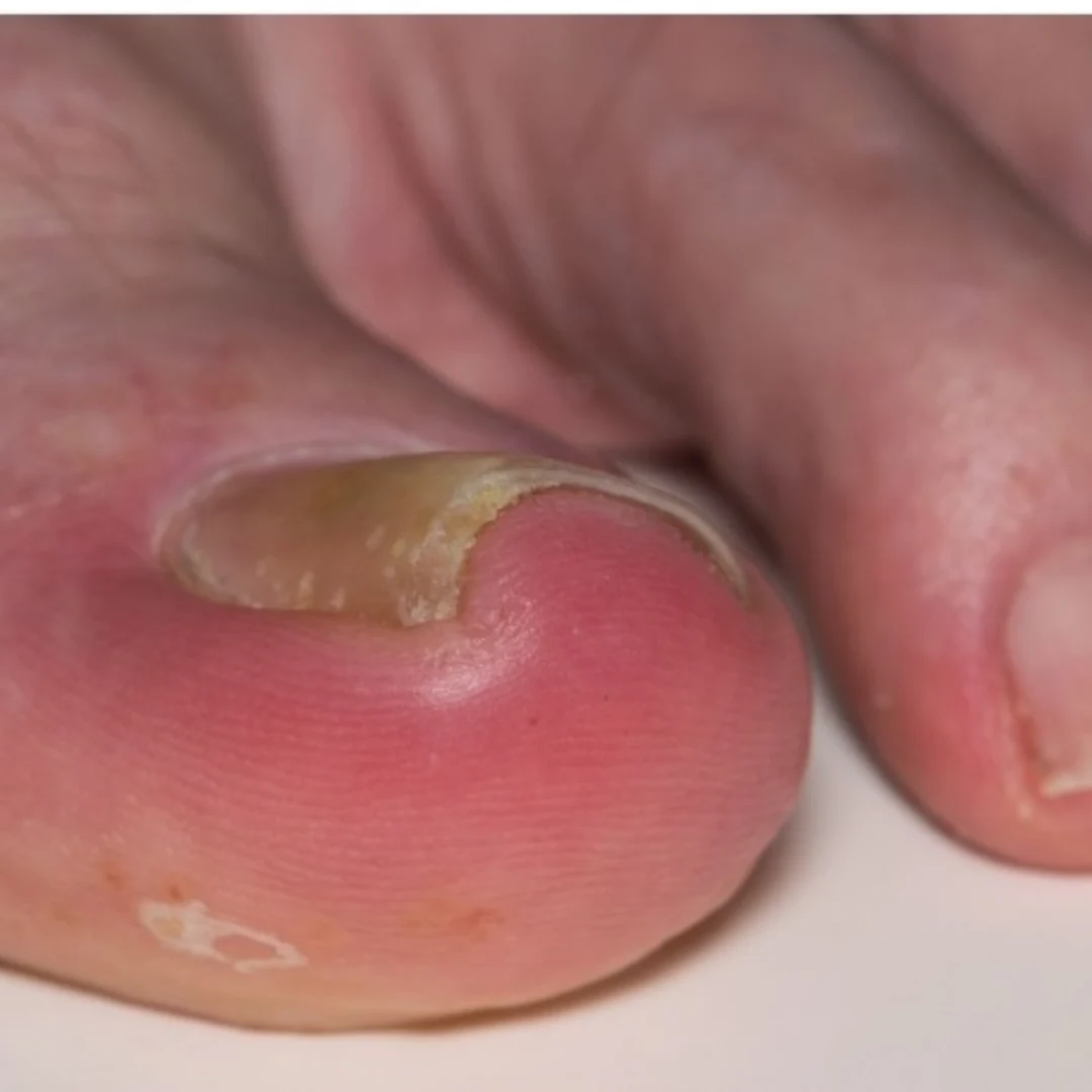Mobile Foot Care | Dungarvan