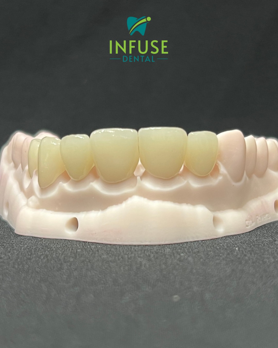Infuse - “My teeth are worn down, and I’m embarrassed to smile… What ...