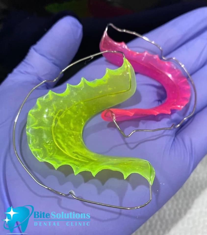 Mango Square - Custom Color Retainers! at Bite Solutions... | Facebook