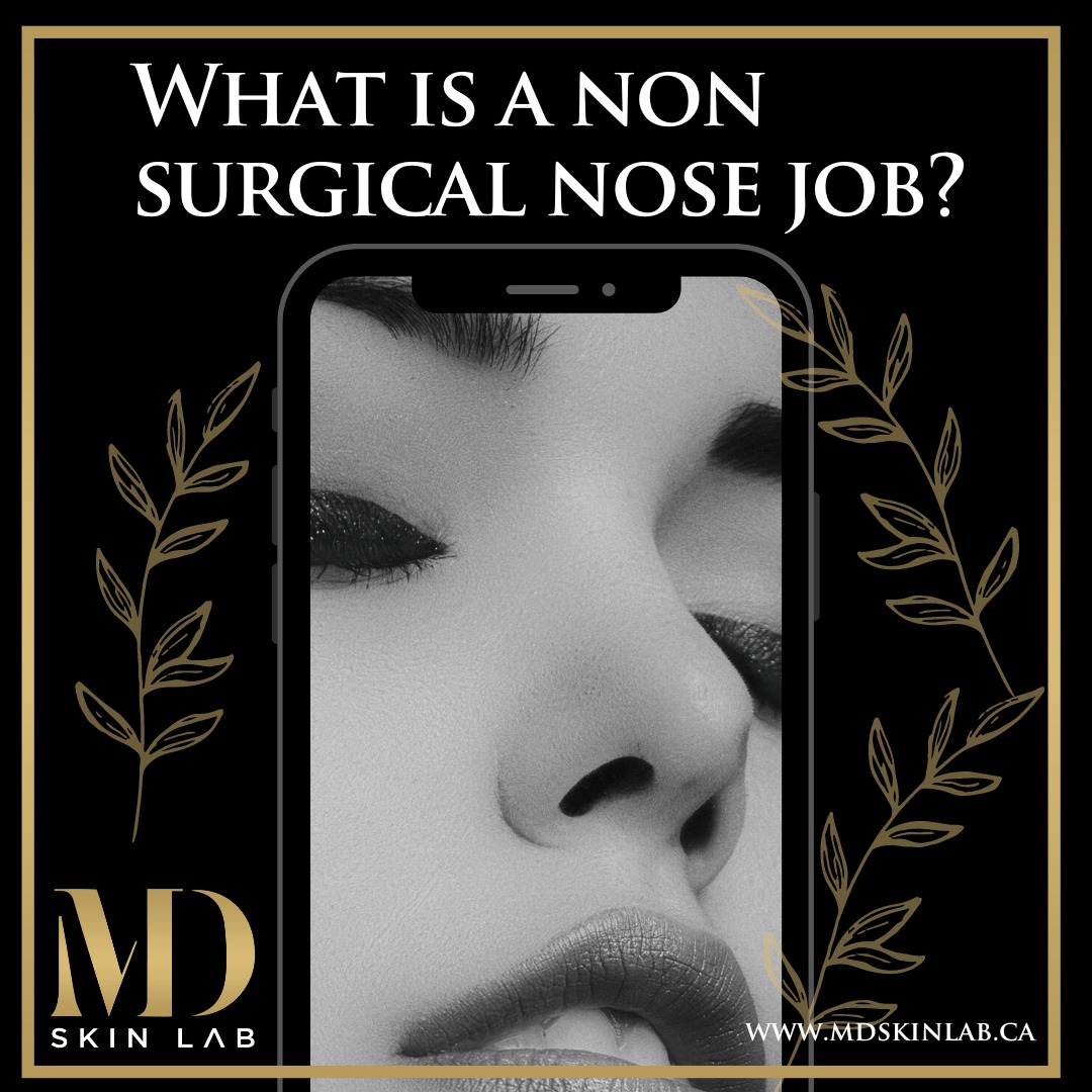 MD Skin Lab - What is a Non-Surgical Rhinoplasty ️...