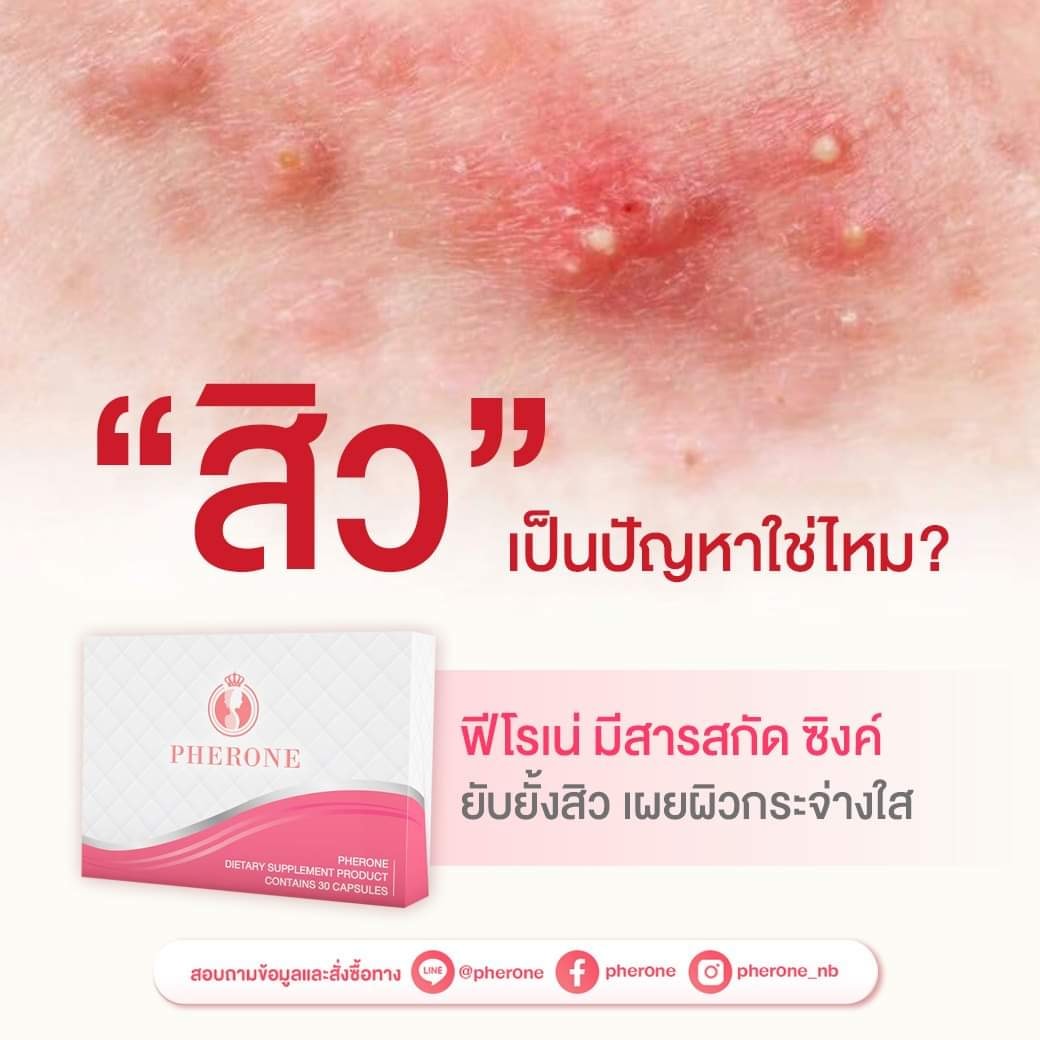 Pherone ฟีโรเน่ - “สิว”เป็นปัญหาใช่ไหม? รู้หรือไม่?... | Facebook