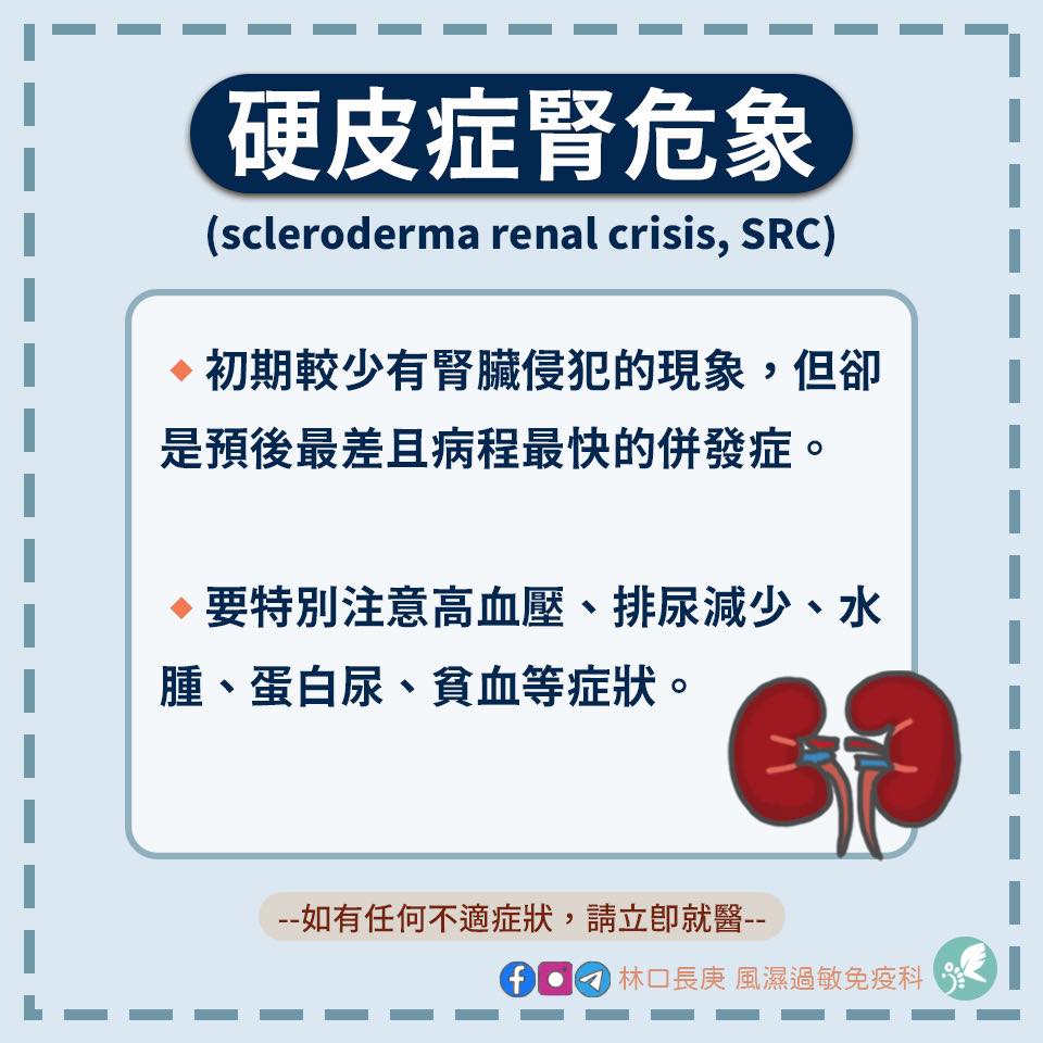 林口長庚風濕過敏免疫科 - 硬皮症腎危象⚠️ 硬皮症又稱全身性硬化症， 不只皮膚會變硬，🌴...