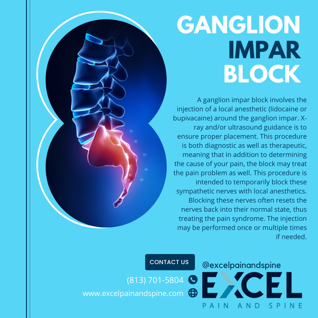 Excel Pain and Spine - A ganglion impar block is a procedure used to ...