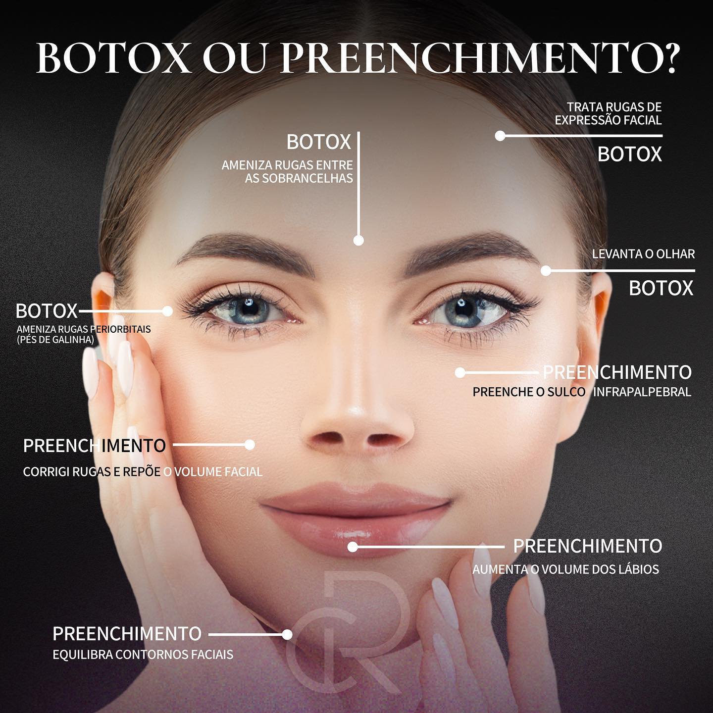 Botox ou preenchimento? Qual será... - Dra. Regiane Carvalho