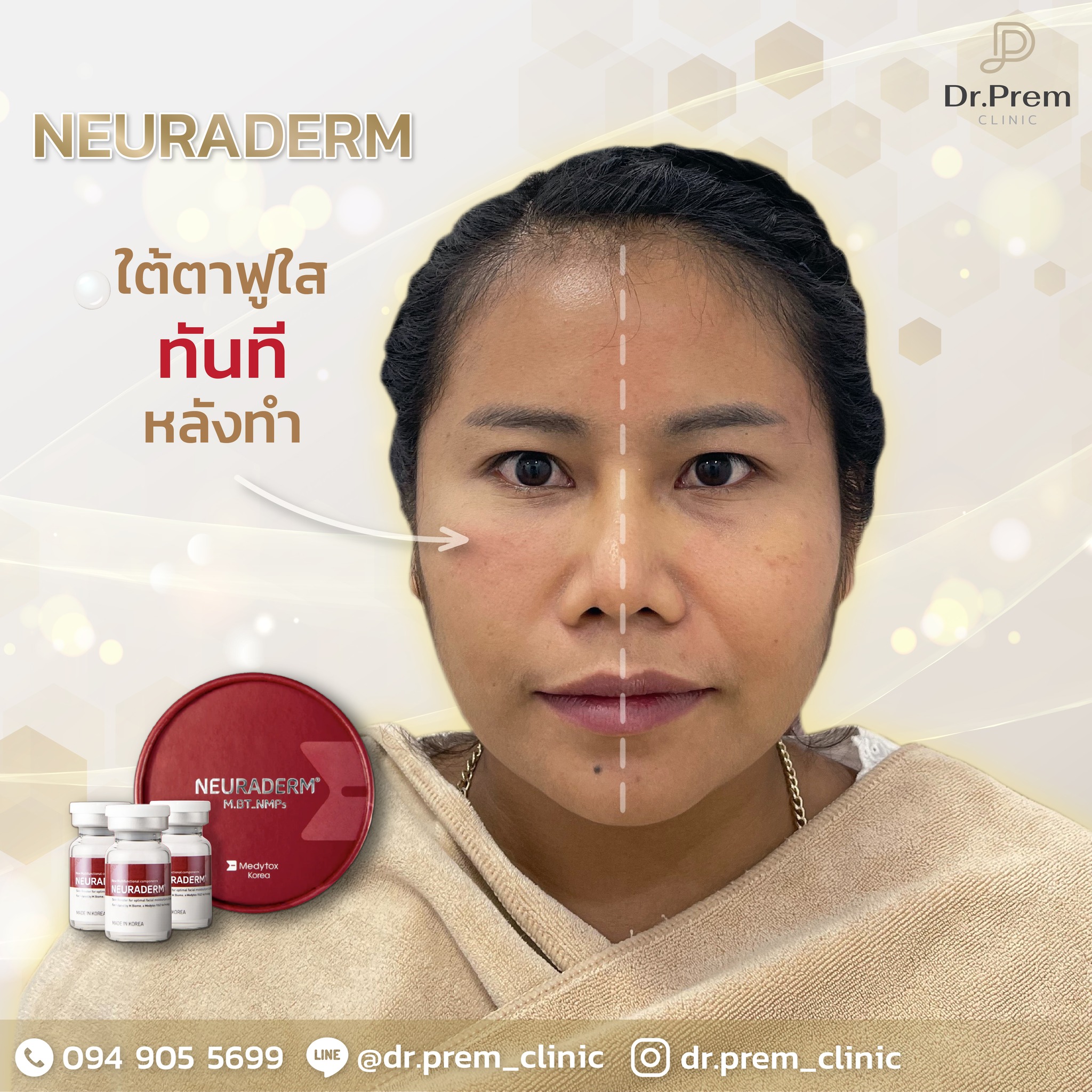 Dr.Prem Clinic สาขา เพชรบุรี ดอกเตอร์เปรมคลินิกเวชกรรม - 🔥 ฟื้นฟูขอบตา ...