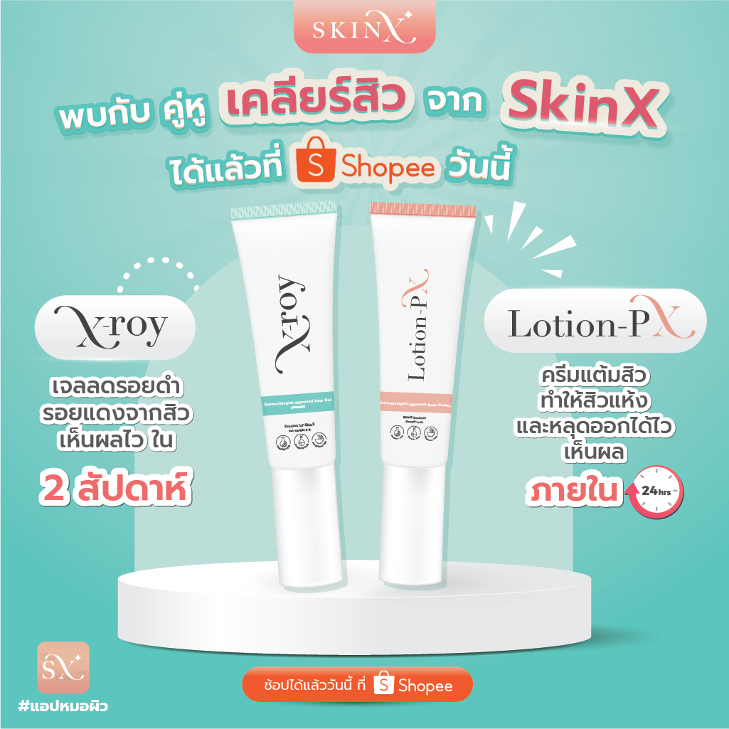 มาแล้วววว !! คู่หู... - SkinX พบแพทย์ผิวหนังออนไลน์ | Facebook
