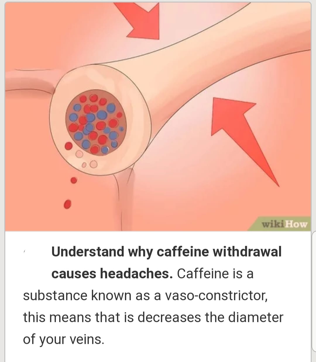 caffeine withdrawal migraine acetyl l-carnitine What helps with headaches? TB-500 Nasal Spray, 8mg Taille:25 kilogrammes (55 livres) osteoporosis and lysine