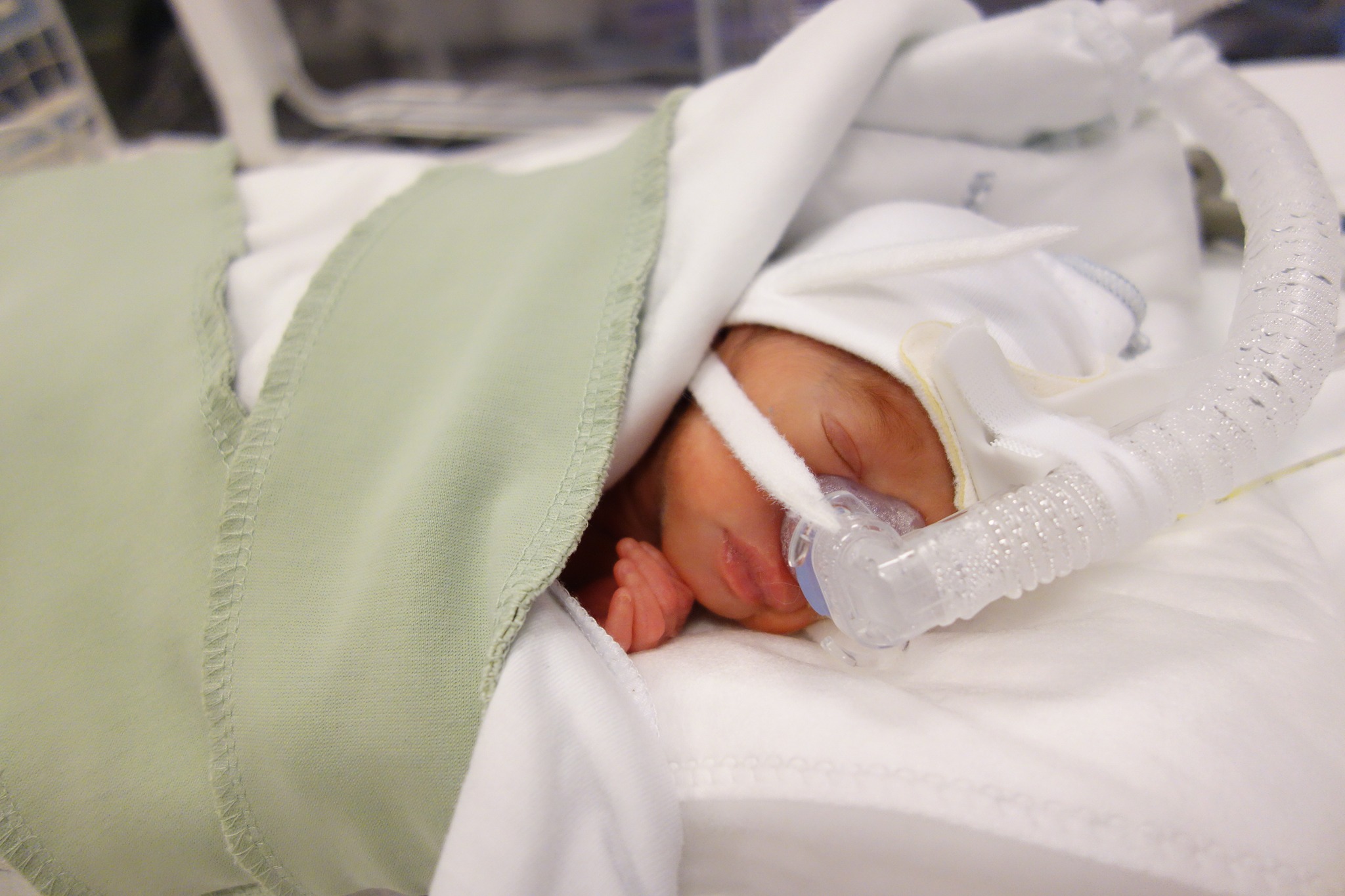 Neonatal-IVA US Linköping | Linköping