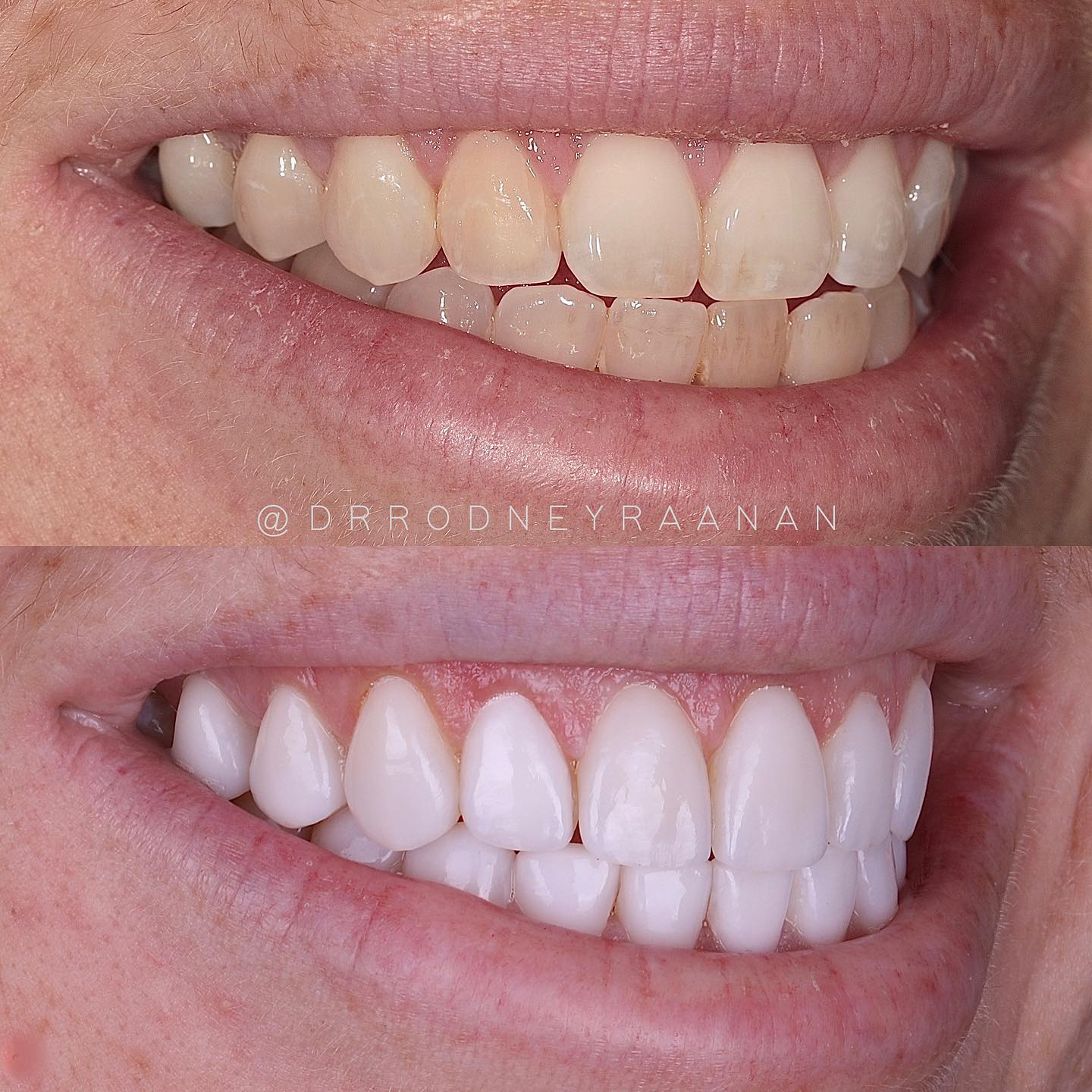 This patient was unhappy... - Dr. Rodney Raanan, DDS MMSc | Facebook