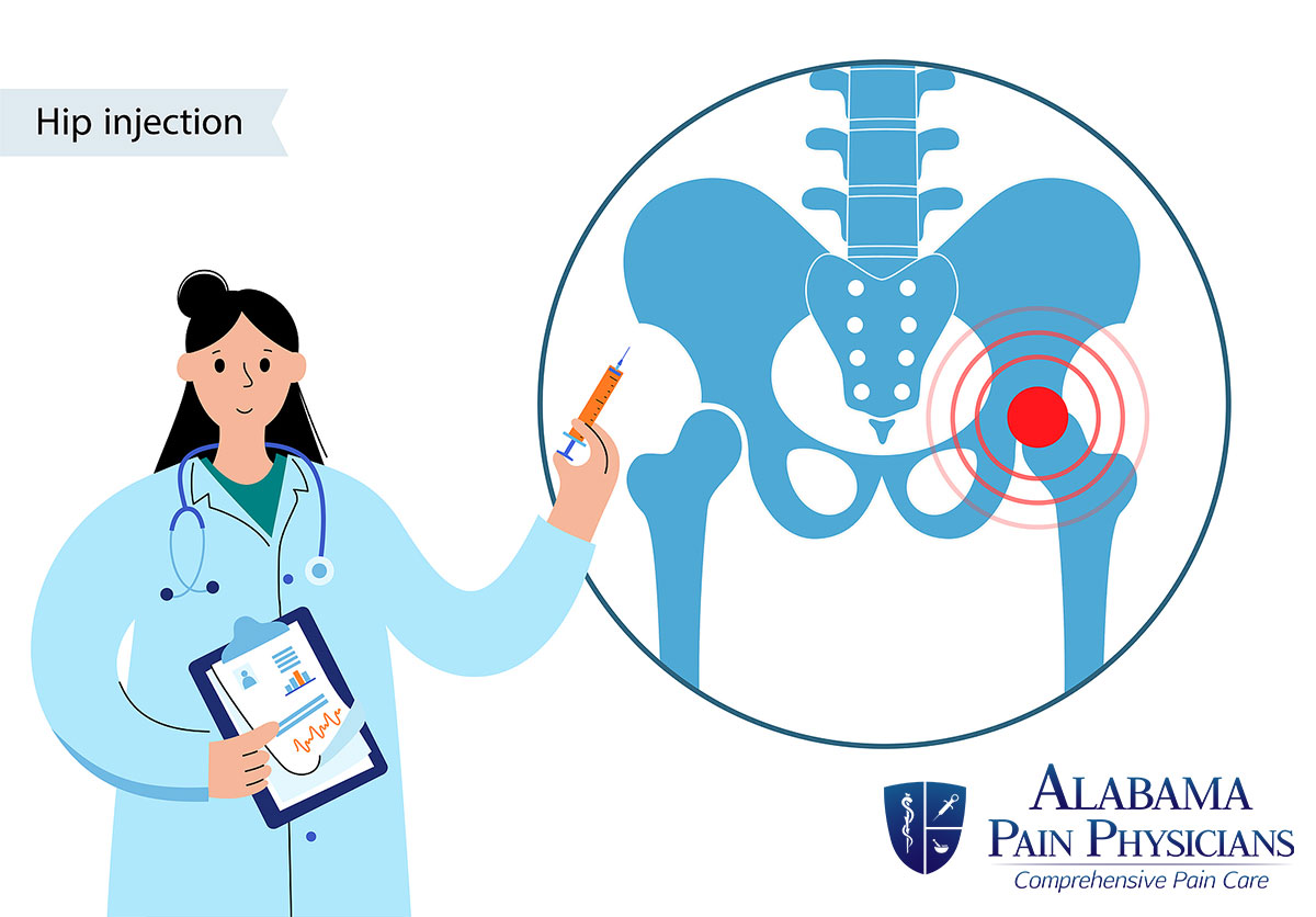 Procedure Spotlight: A Hip Joint... - Alabama Pain Physicians | Facebook