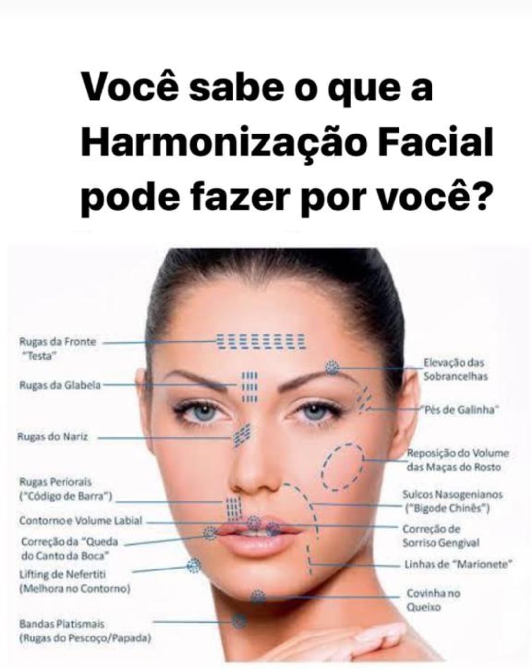 Dra. - Harmonizar significa alcançar a simetria das formas e contornos ...