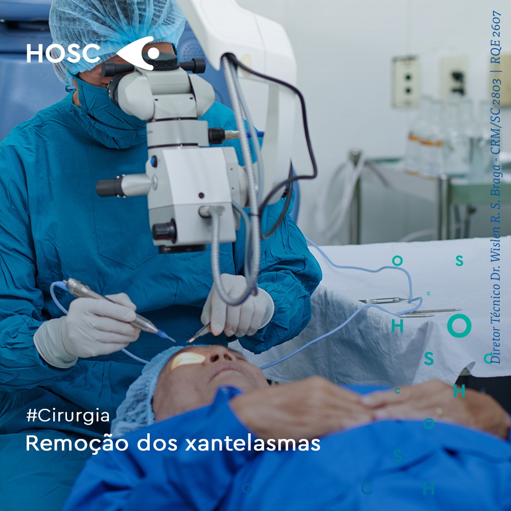 A cirurgia é... - HOSC - Hospital de Olhos de Santa Catarina | Facebook