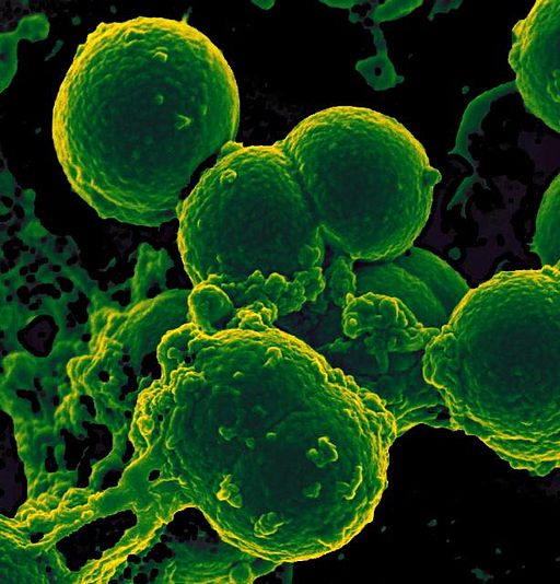 Skin Deep: The Skin Microbiome Project