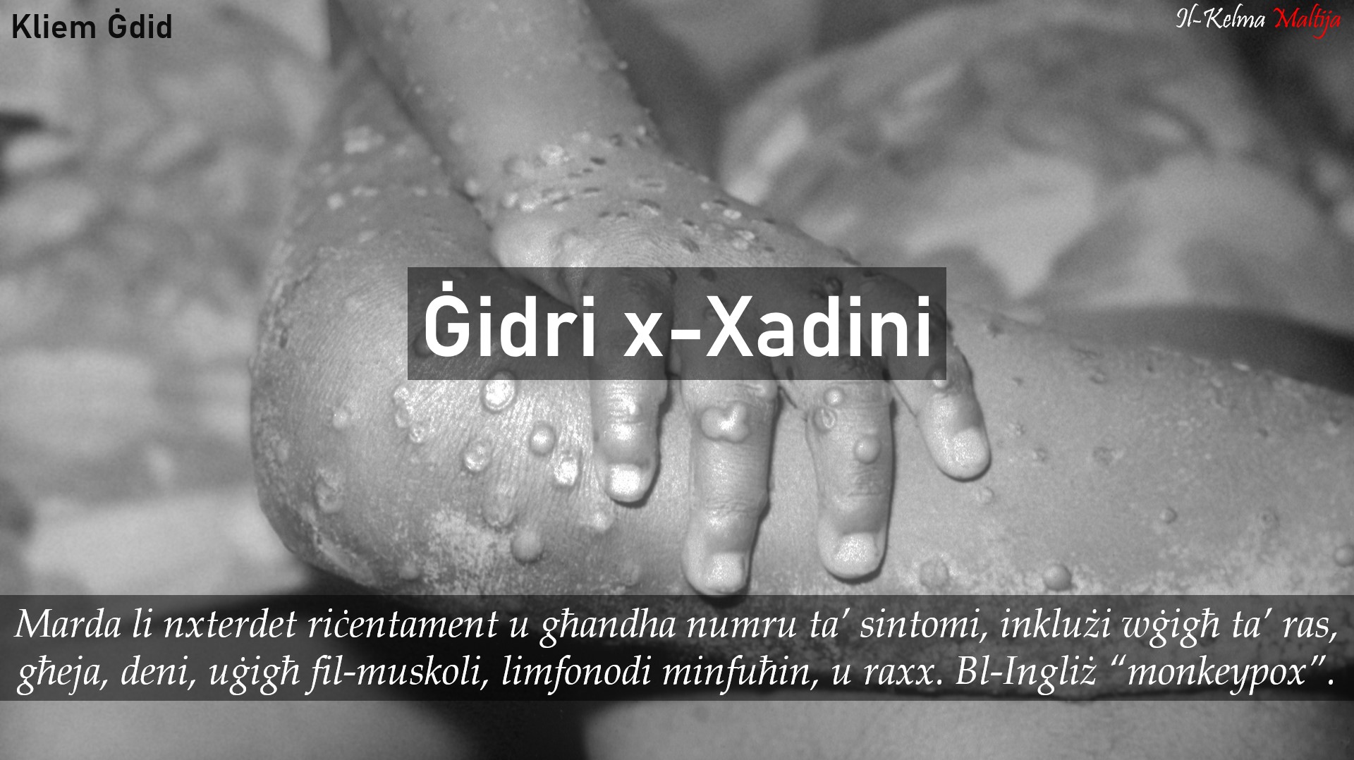 Pajjiżi oħrajn jużaw terminu... - Il-Malti Madwarna
