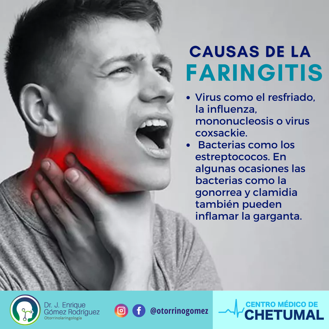 Otorrinolaringología Dr. José Enrique Gómez Rodríguez - La #Faringitis ...