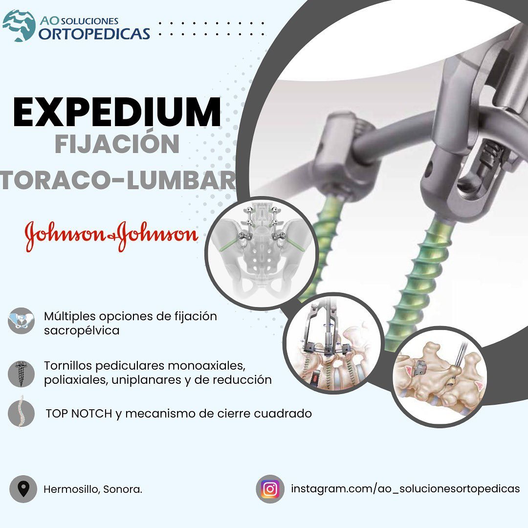 El sistema EXPEDIUM®️ 5.5... - AO Soluciones Ortopedicas