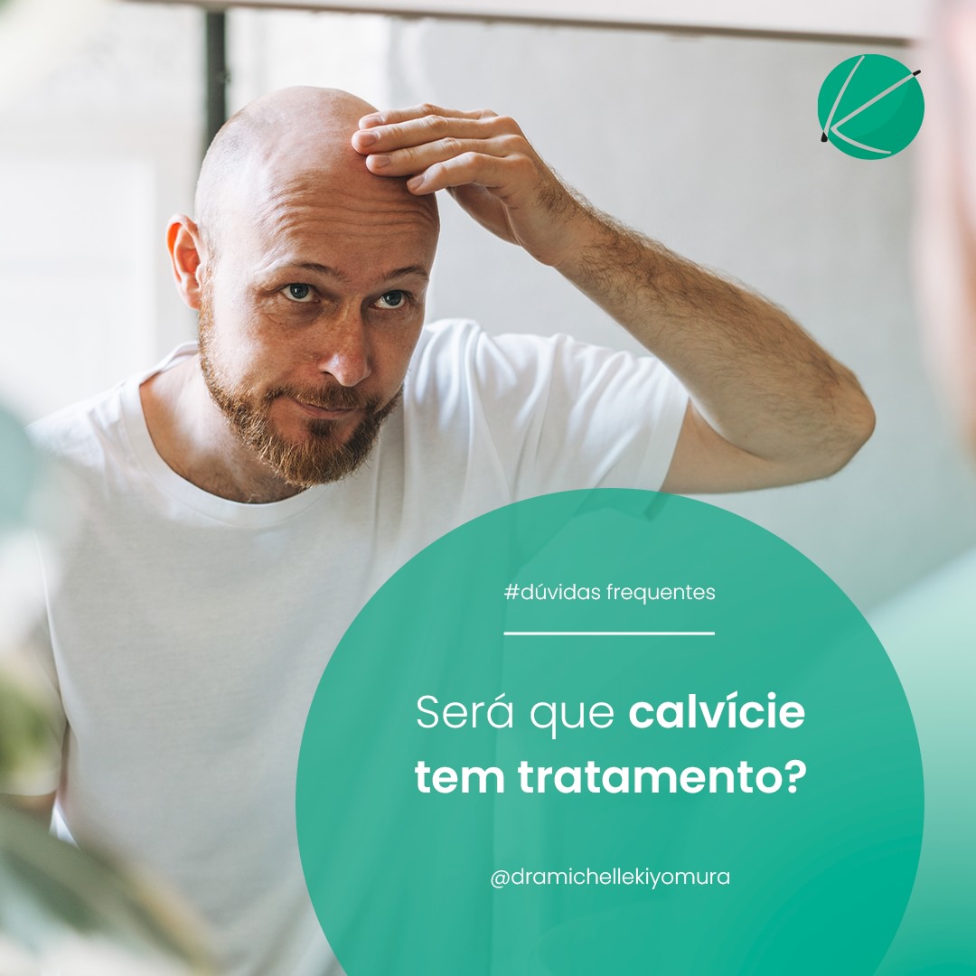 A calvície é um problema muito comum... - Clínica Kiyomura | Facebook