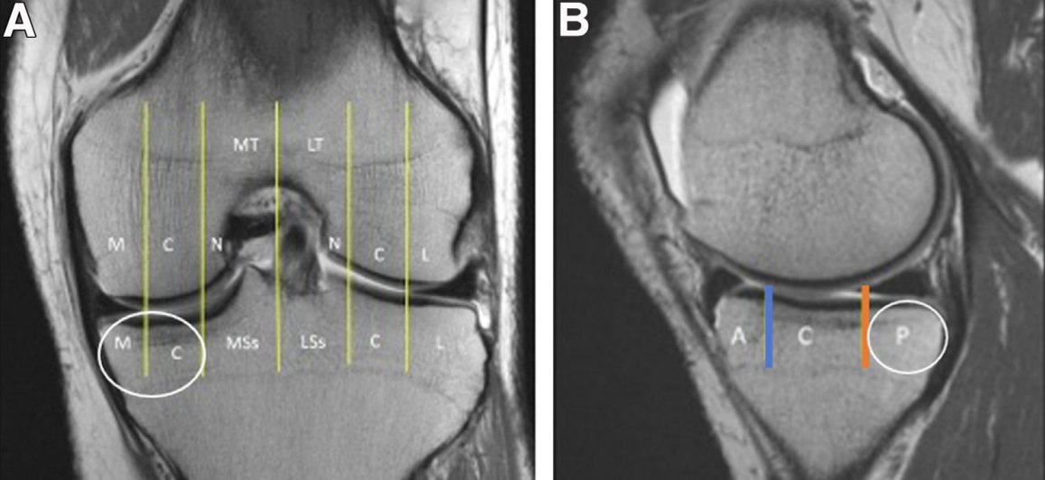 New Dr. LaPrade Study! Over One-Third of Patients With Multiligament ...