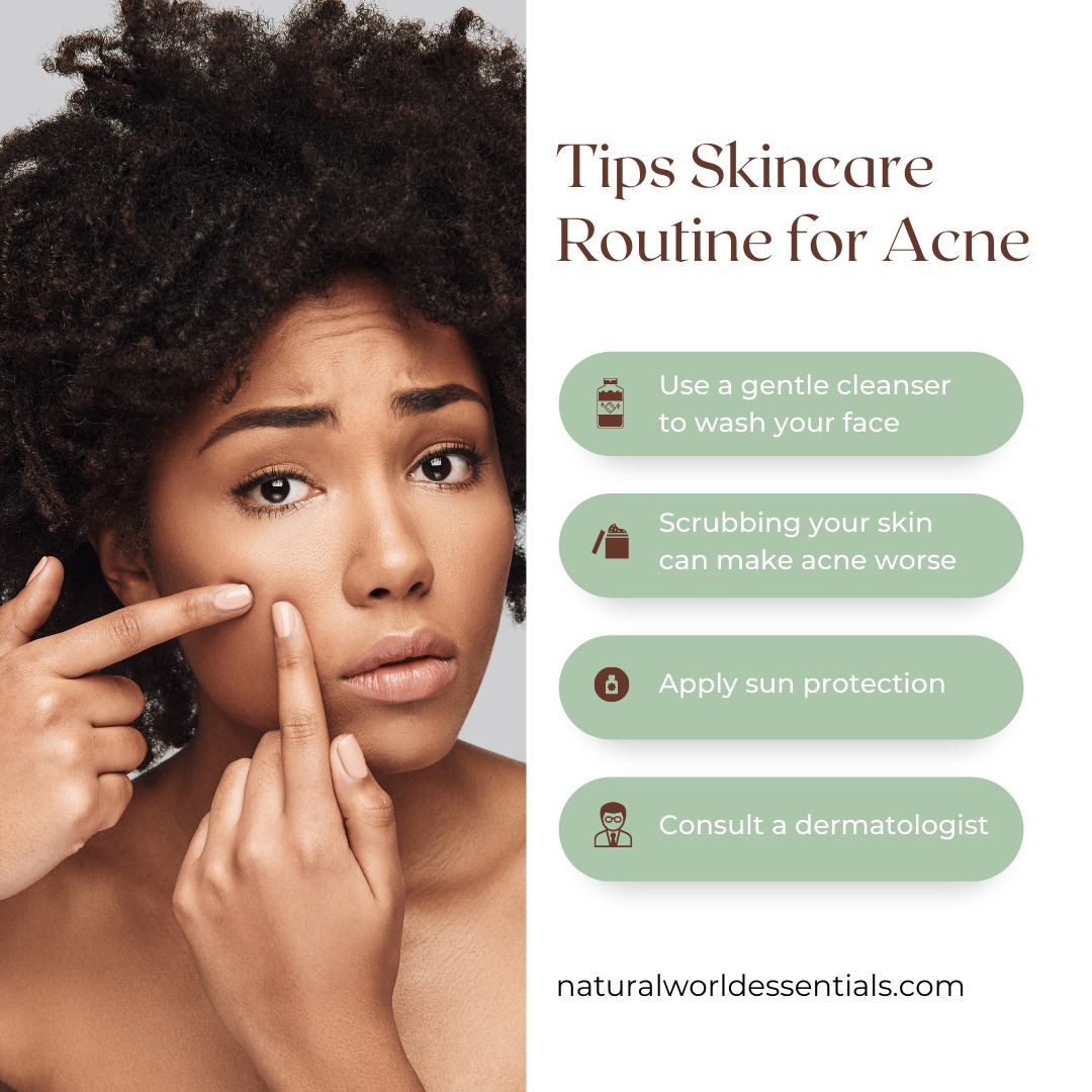 Natural - 🤔 Wondering how to create the best skincare routine for acne ...