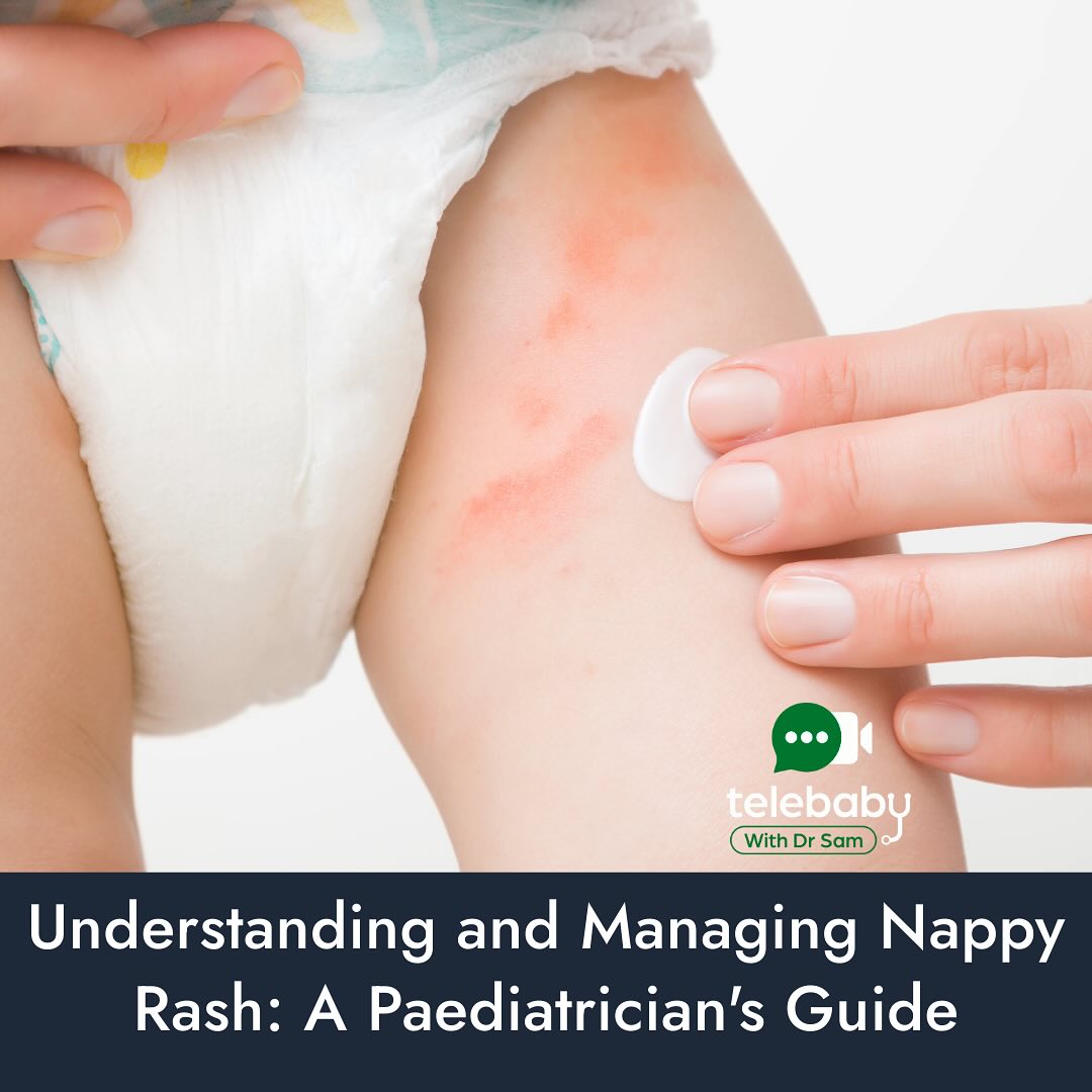 Telebaby - 👶 Understanding and Managing Nappy Rash Nappy... | Facebook