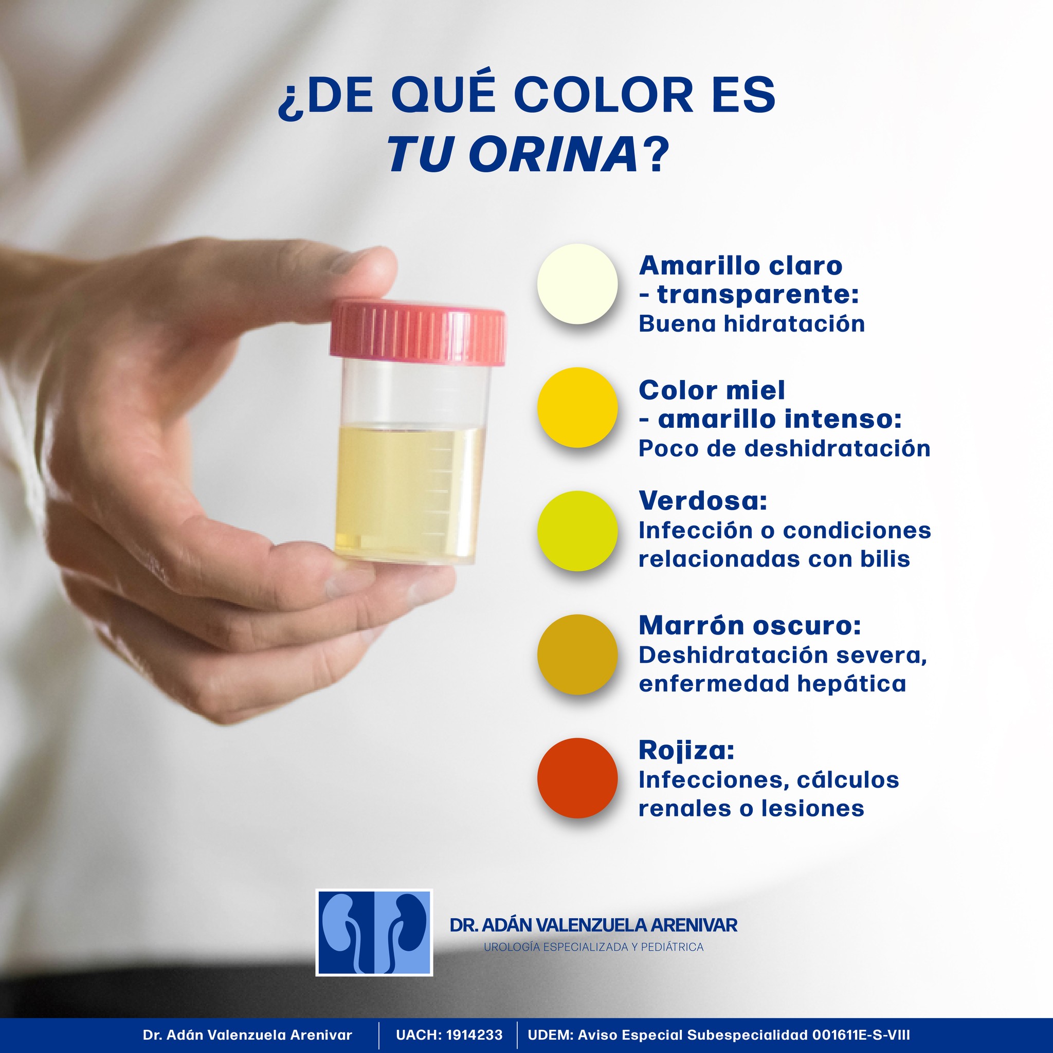Dr. Adán Valenzuela Arenivar - Urólogo en Chihuahua - ¿𝗗𝗲 𝗾𝘂𝗲́ 𝗰𝗼𝗹𝗼𝗿 𝗲𝘀 ...