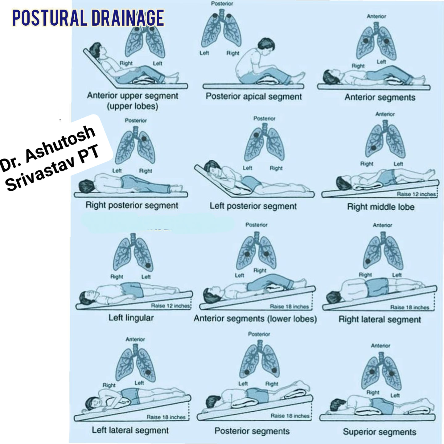 #Postural #drainage... - Dr.Ashutosh Srivastav -PT | Facebook