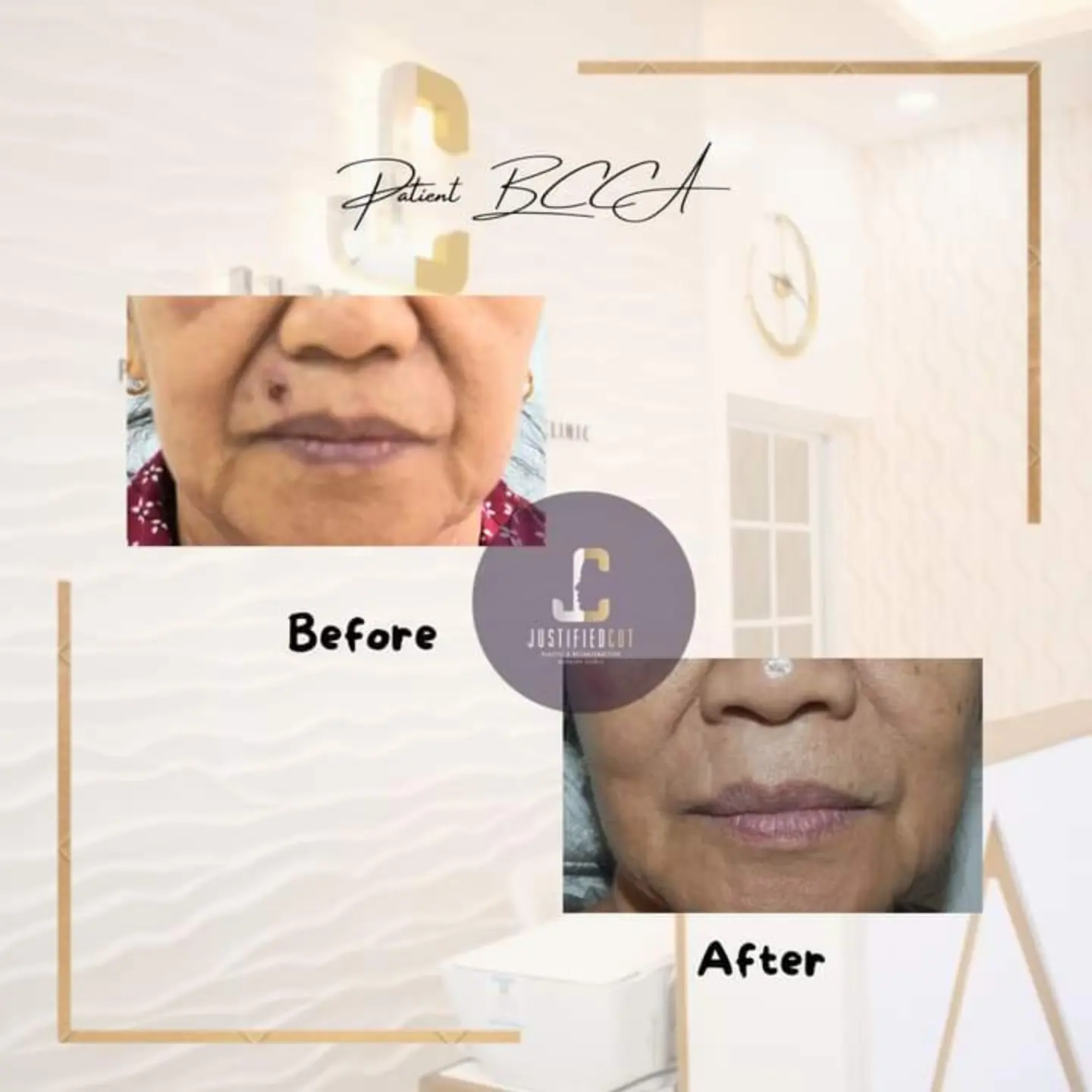 Bas... - Justified Cut Plastic & Reconstructive Surgery Clinic