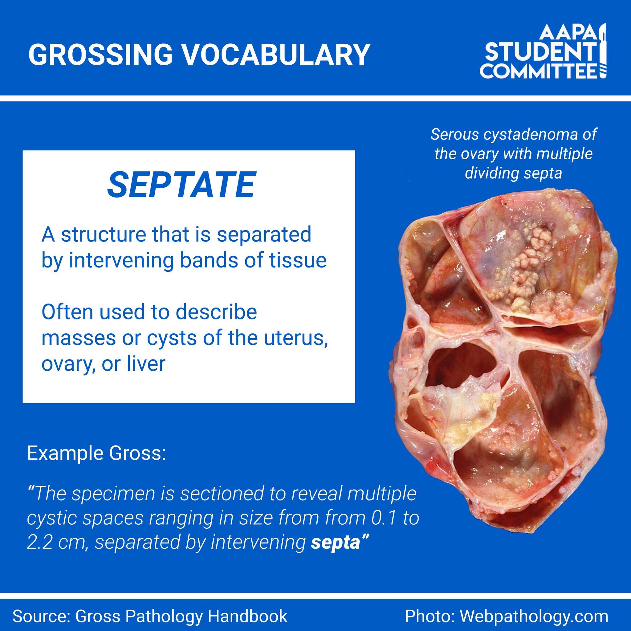 What does the Latin root septem mean? A. Septum B. Seven C. Severe