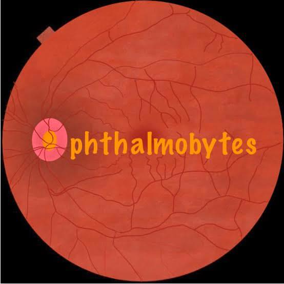 Ophthalmobytes - 𝐁𝐥𝐨𝐨𝐝𝐲 𝐞𝐲𝐞!⁣ ⁣ Hyphema : Accumulation of red blood ...