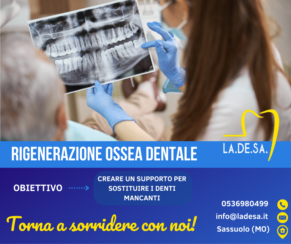 20 Anni di Rigenerazione Ossea Guidata in Implantologia
