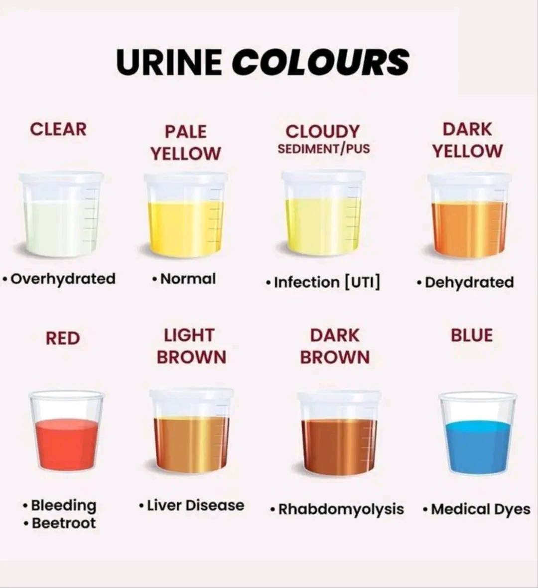 Urine colour and interpretation ✓