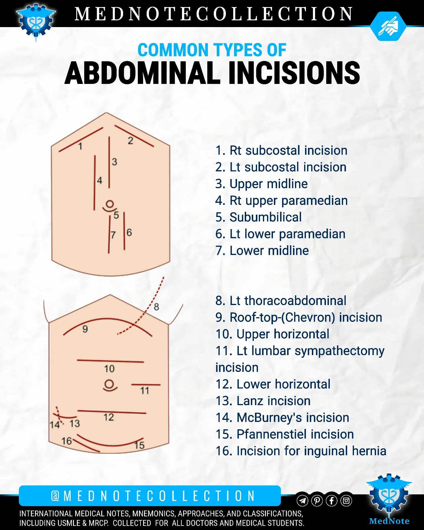 MedNote Collection - 🧠 ABDOMINAL INCISIONS MedNote Collection
