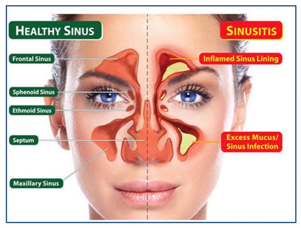 Dev ENT Hospital and vertigo Clinic | Bhilwara