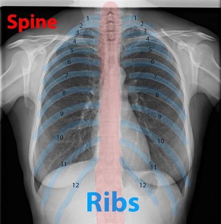 How to count the rib... - Radiology Students Of A.M.S