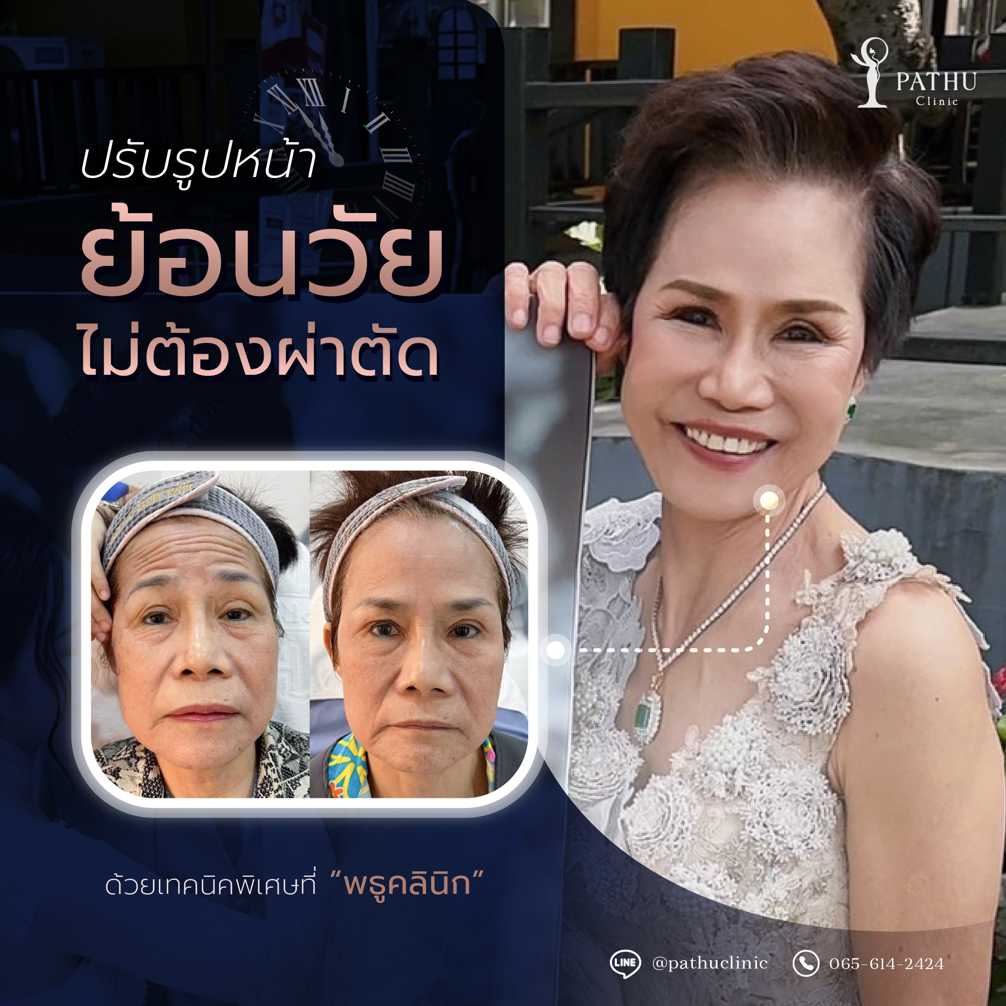 🔥เปิดศักราชใหม่กับหน้าใหม่ที่สุด... - Pathu Clinic - พธูคลินิก | Facebook