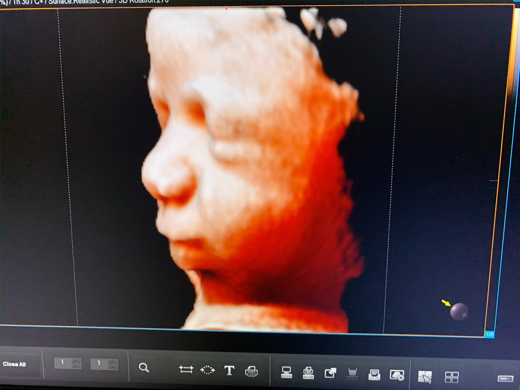Amazing Scan - Premium Early Gender and 5d/4d/3d Baby Ultrasound ...