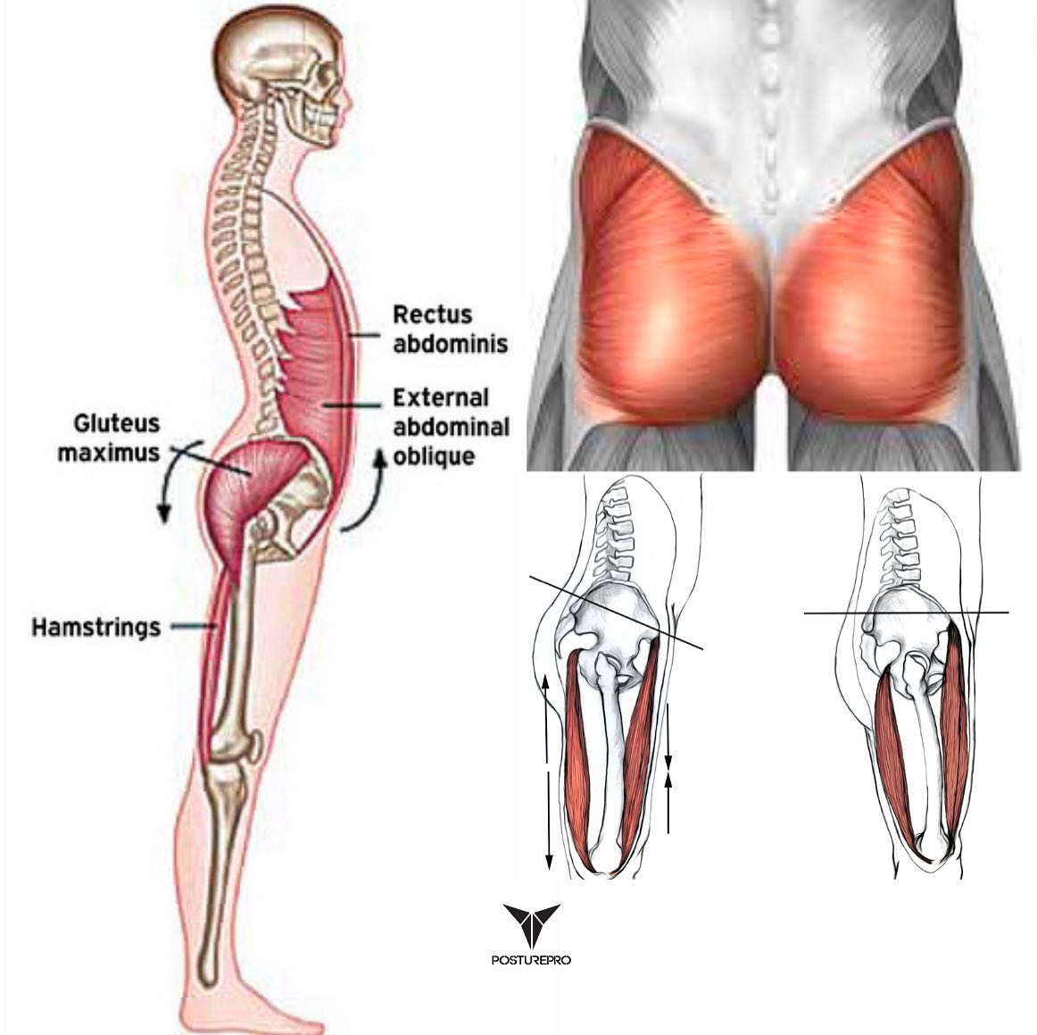 Posturepro - The gluteal muscles play a crucial role in counteracting ...