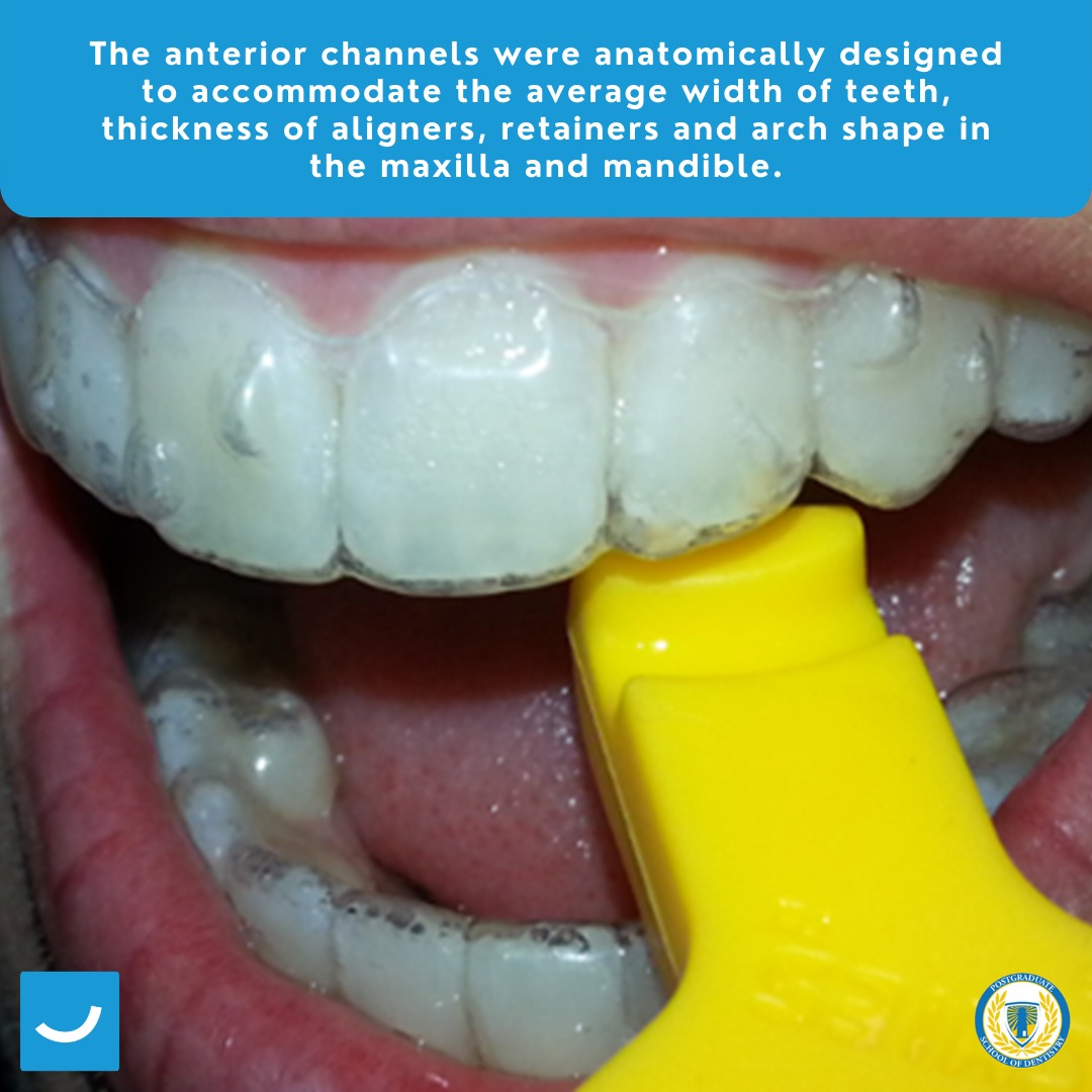 1122Corp - The anterior channels were anatomically designed to ...