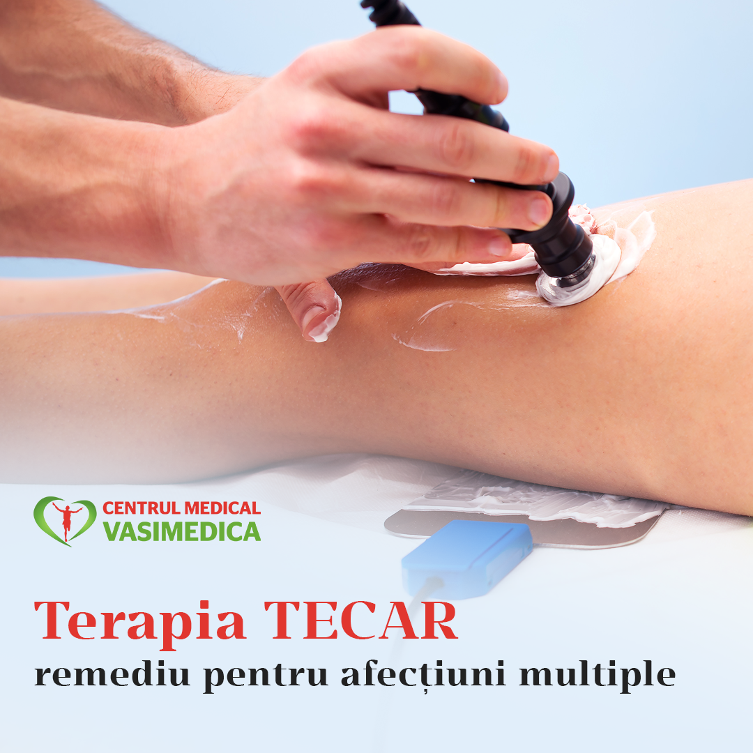 Terapia TECAR este una dintre... - Centrul Medical Vasimedica