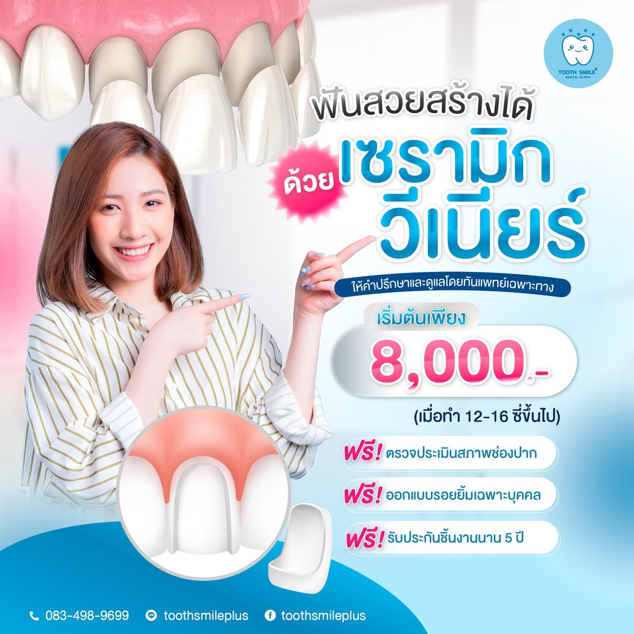 💁‍♀️ ฟอกสีฟันแล้ว ฟันก็ขาวขึ้นนะ แต่อยากขาวกว่านี้อีก!!!!!! "วีเนียร์ ...
