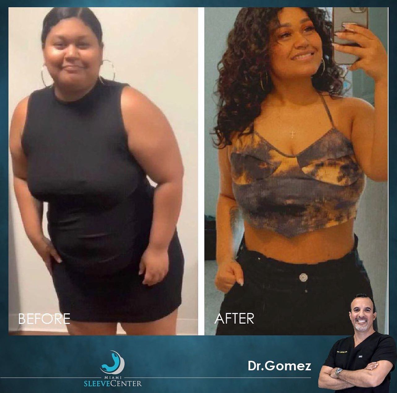 dr max gomez weight loss Image 7