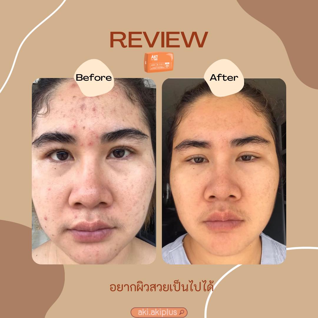 Akiplus - รีวิวปัง ขนาดนี้ ได้ลองทานเอง จะปังขนาดไหน ถ้าอยากรู้ Aki ...