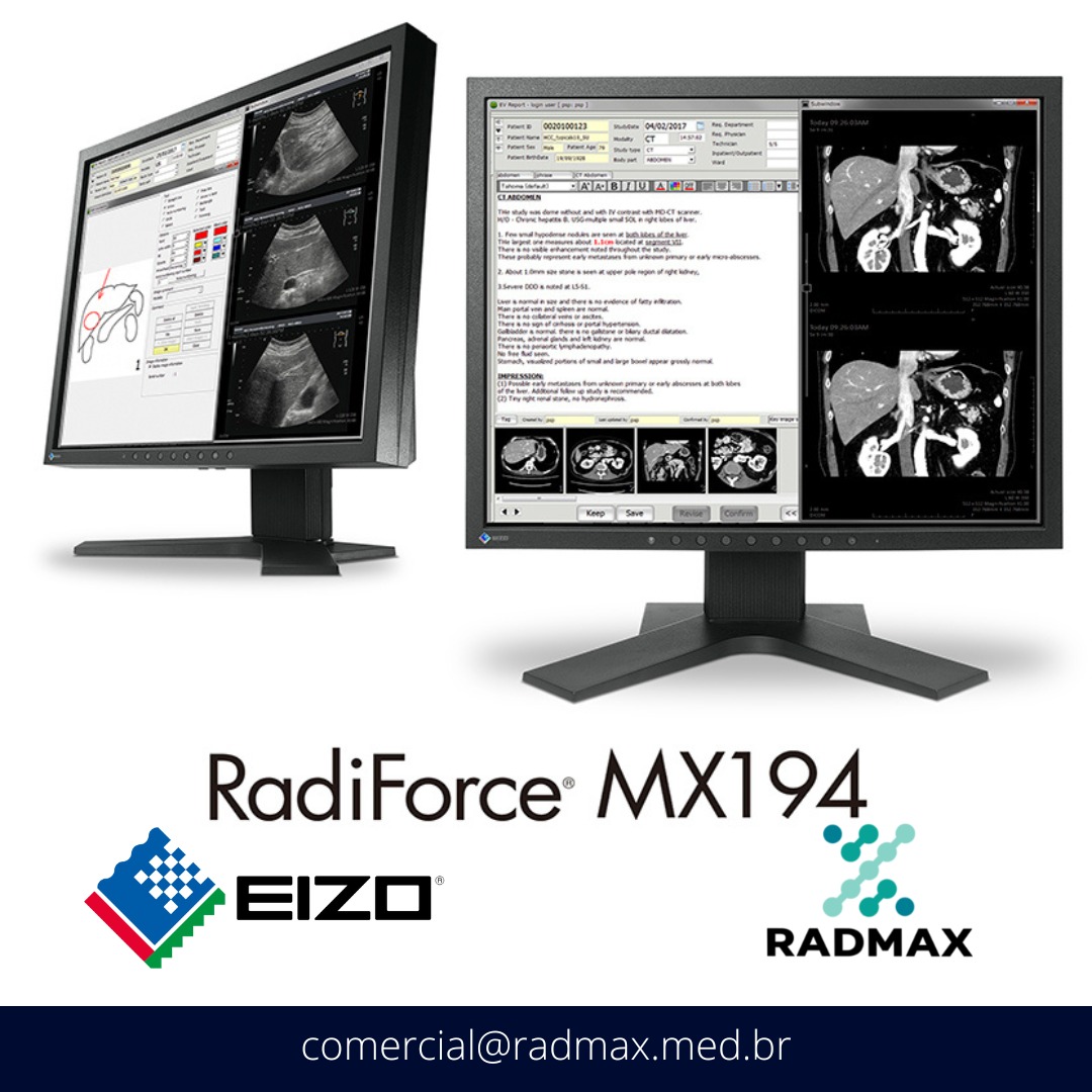 O monitor MX194 da EIZO,... - RadMax Equipamentos Medicos