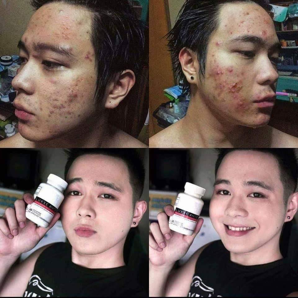 luxxe white enhanced glutathione amazon Try the new LUX International Smooth & Radiant and let your skin glow with and sericin for a smoother, brighter look✨ #LuxSuperStar #LuxBangladesh #Lux #LuxInternational #GetGlutaGlow Skin Brightening Serum