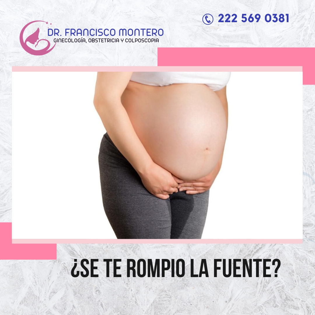 Dr - 👶💧 ¿SE TE ROMPIO LA FUENTE? 💧👶 ¿Sabías que la ruptura de membranas ...