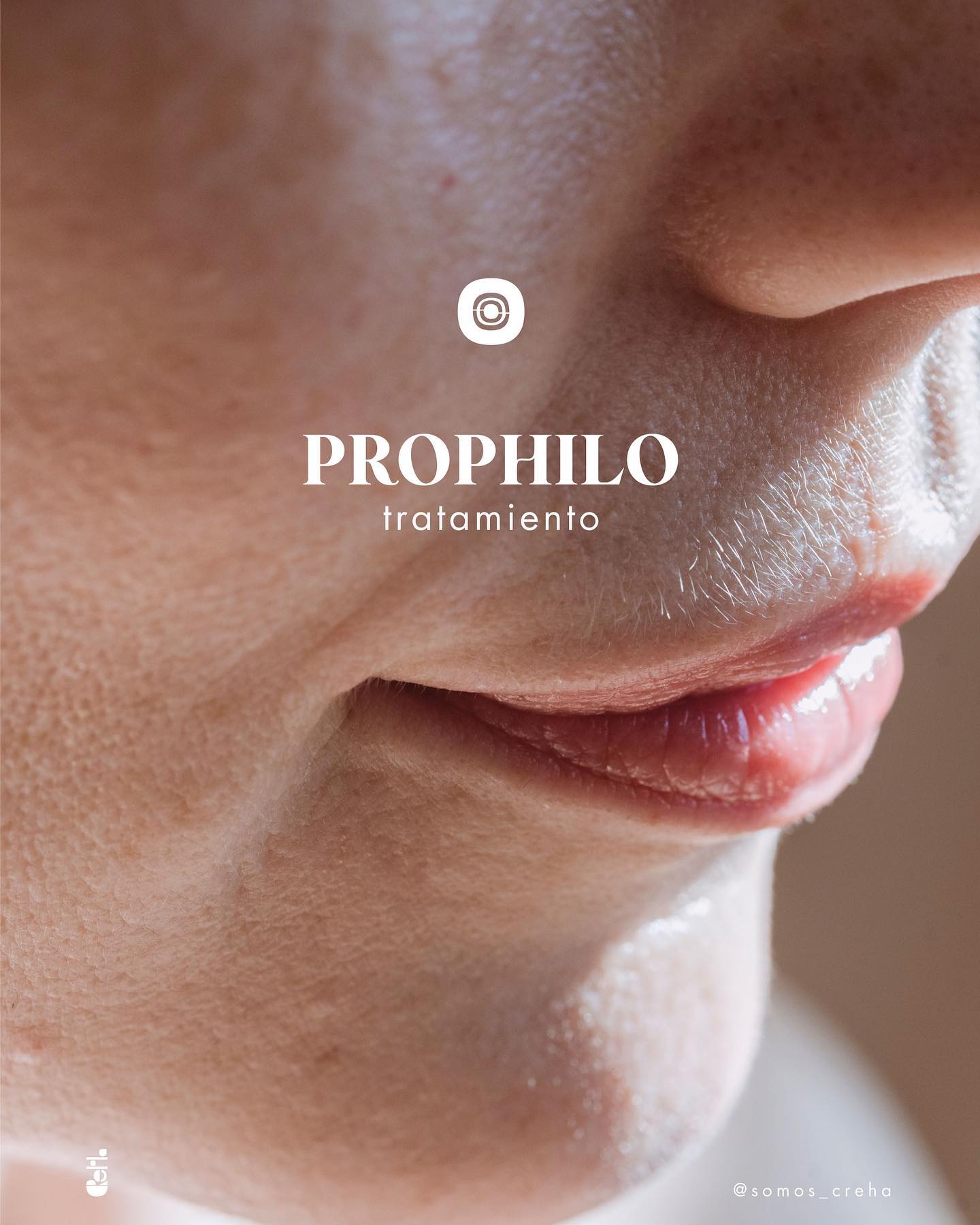 CREHA - Profhilo, para una piel hidratada, luminosa y fortalecida. El ...