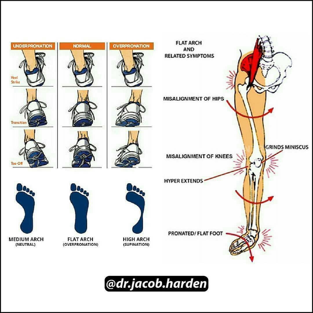 PhysioOsteoBook - WHY YOUR ARCHES ARE SO IMPORTANT by Dr. Jacob Harden ...