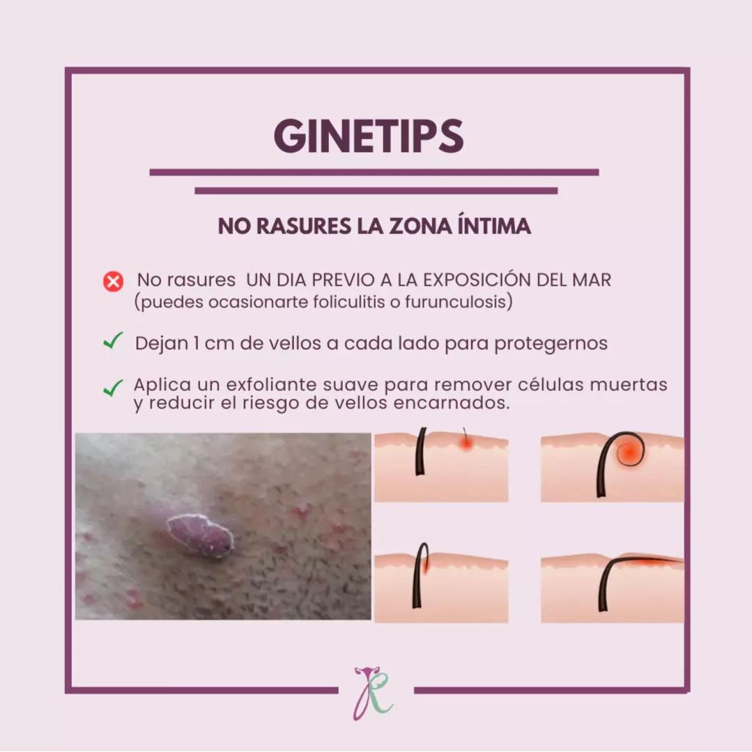 ¡ NO RASURES LA ZONA... - Dra. Julieta Del Razo Ginecóloga | Facebook