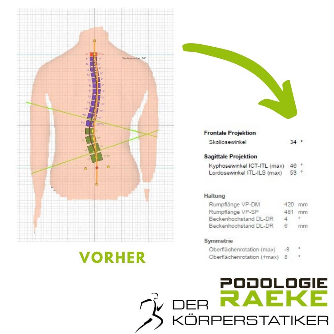 Podologie Raeke - Der Körperstatiker | Stockerau