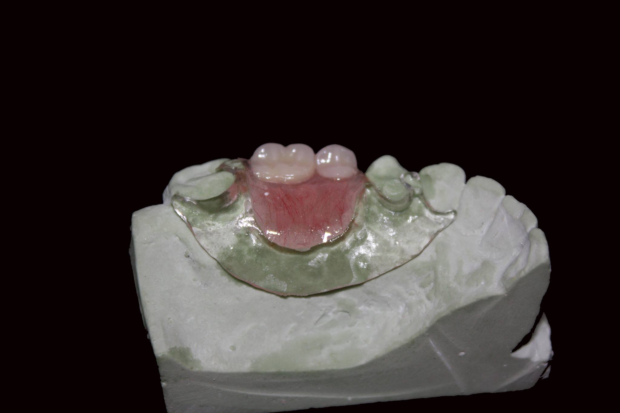 AvaDent Digital Dental... - AvaDent Digital Dental Solutions